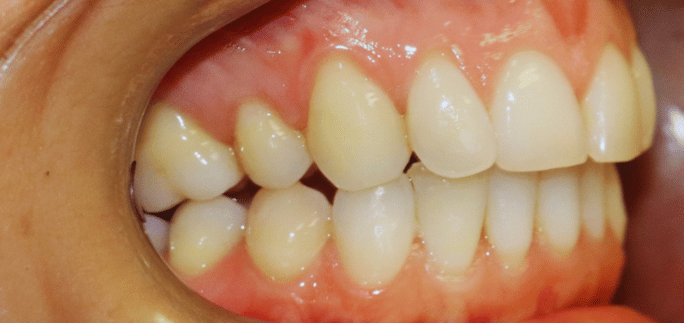 After - Merrow Park Dental 