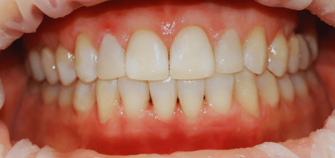 After - Merrow Park Dental 