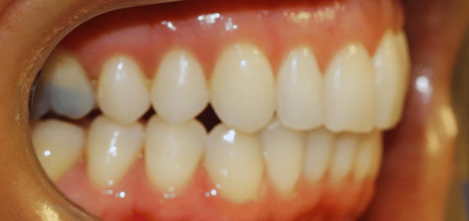 After - Merrow Park Dental 