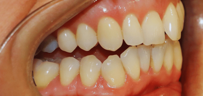 Before - Merrow Park Dental 