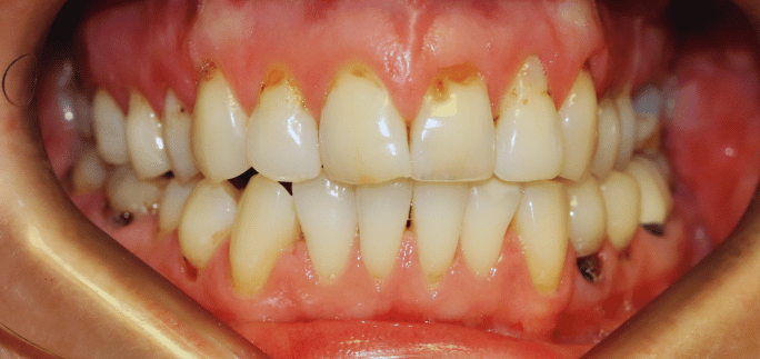 Before - Merrow Park Dental 